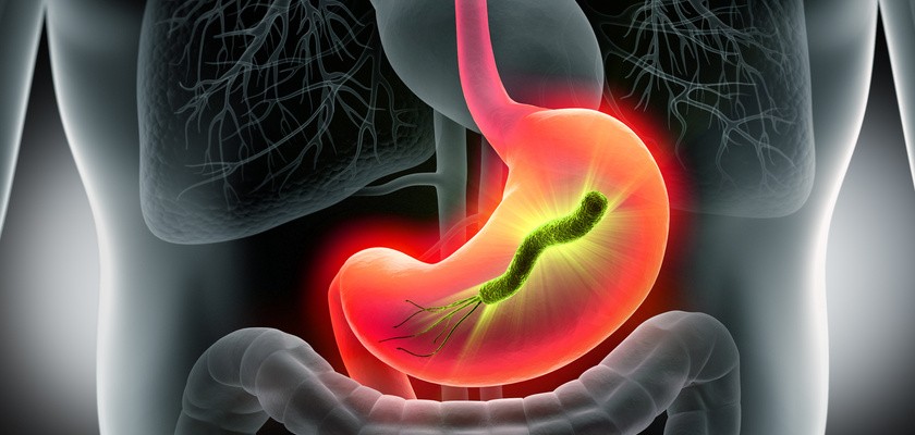 Helicobacter pylori.