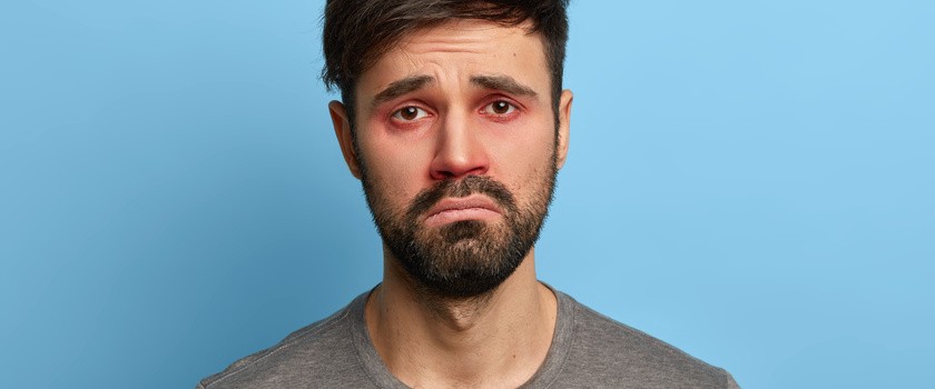 Nieszczęśliwy, niezadowolony mężczyzna ma czerwone opuchnięte oczy z powodu zapalenia spojówek.