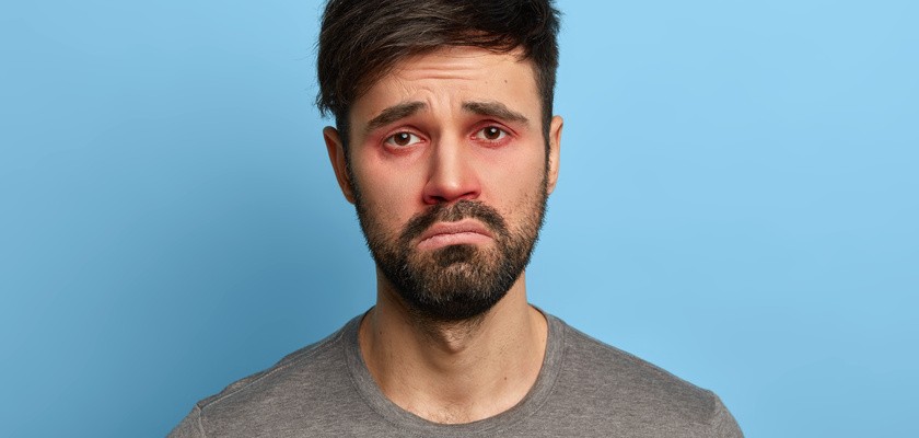 Nieszczęśliwy, niezadowolony mężczyzna ma czerwone opuchnięte oczy z powodu zapalenia spojówek.