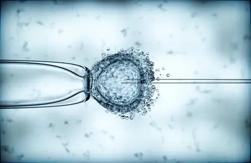 In vitro to zapłodnienie poza orgaznimem kobiety.