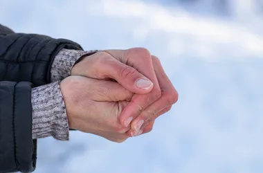 Zamrożone dłonie kobiet na zimno. Dłonie kobiet z suchą skórą i czerwonymi palcami na zimnie.