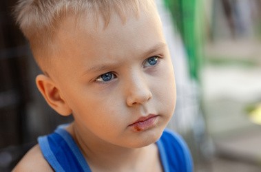Liszaj na twarzy u dziecka i dorosłego – jak wygląda?