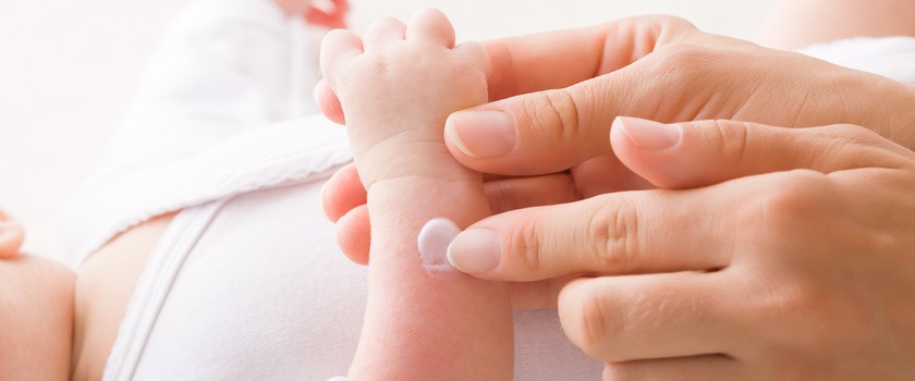 Dorosły nakładający krem na rączki niemowlaka z powodu problemy ze skórą.