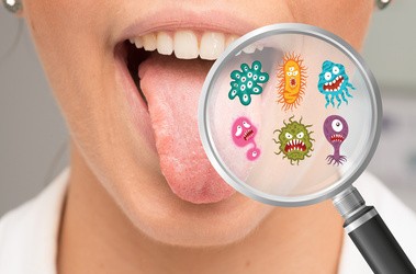 Zapalenie jamy ustnej – przyczyny, objawy, sposoby leczenia