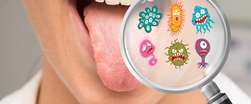 Zapalenie jamy ustnej – przyczyny, objawy, sposoby leczenia