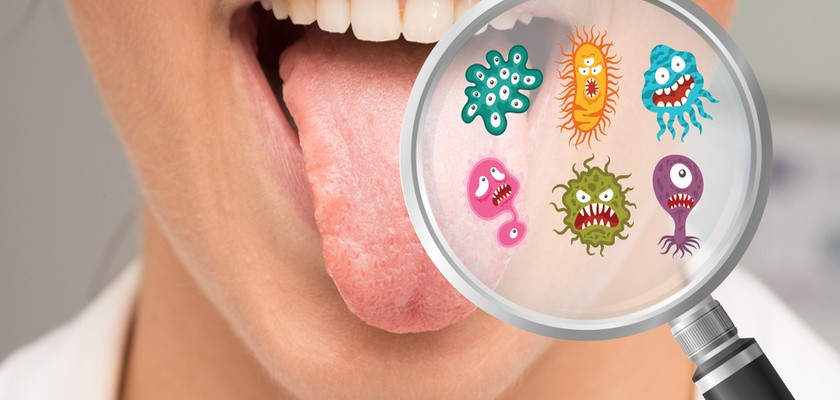 Zapalenie jamy ustnej – przyczyny, objawy, sposoby leczenia
