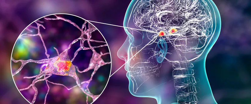 serotonina