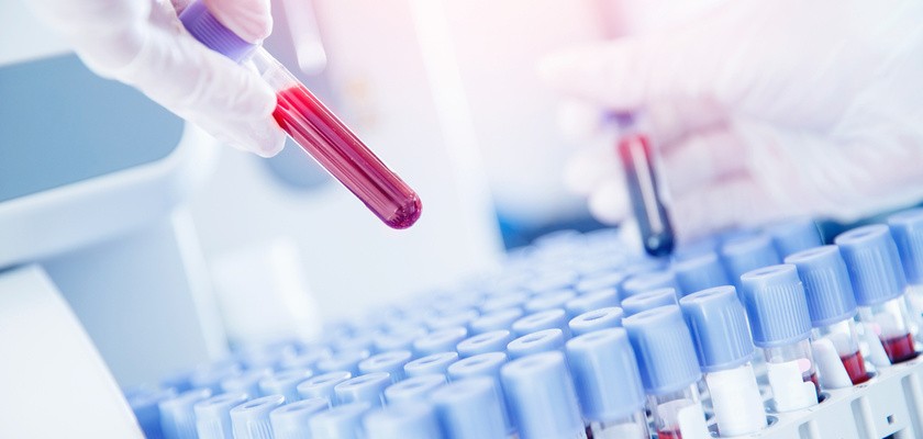 Kiła – objawy i sposoby leczenia