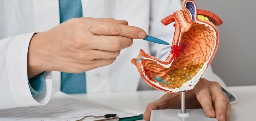 lekarz z modelem naukowym żołądka