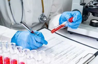 Diagnosta wypełniający formularz na podstawie danych na próbówce.