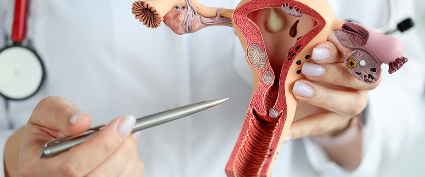 Lekarz ginekolog pokazujący długopisem na plastikowym modelu macicy i jajników.