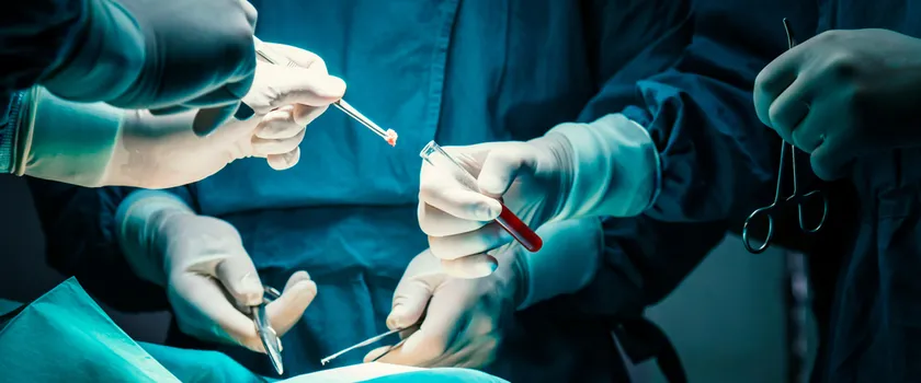 Biopsja – czym jest i kiedy trzeba ją wykonać?