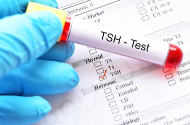 Badanie TSH – jaki wynik jest prawidłowy?