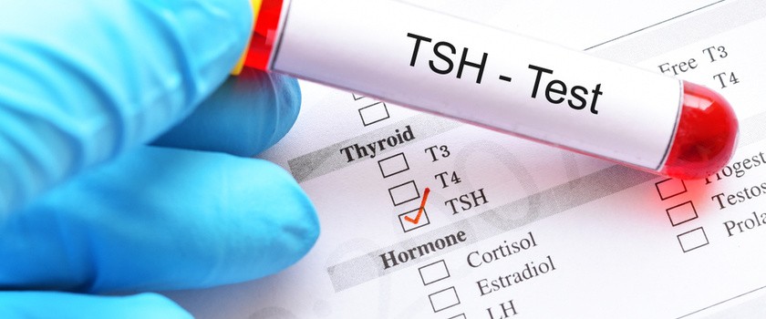 Badanie TSH – jaki wynik jest prawidłowy?