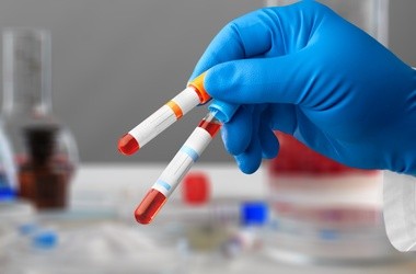 Pracownik laboratorium trzyma w dłoniach dwie próbówki z krwią pacjenta do badania.