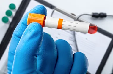 Probówka z próbką krwi do testu analitycznego w laboratorium.