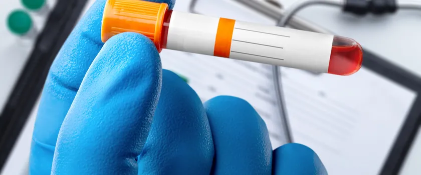 Probówka z próbką krwi do testu analitycznego w laboratorium.