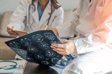 Medycy oglądający wynik badania mózgu. Udar niedokrwienny mózgu.