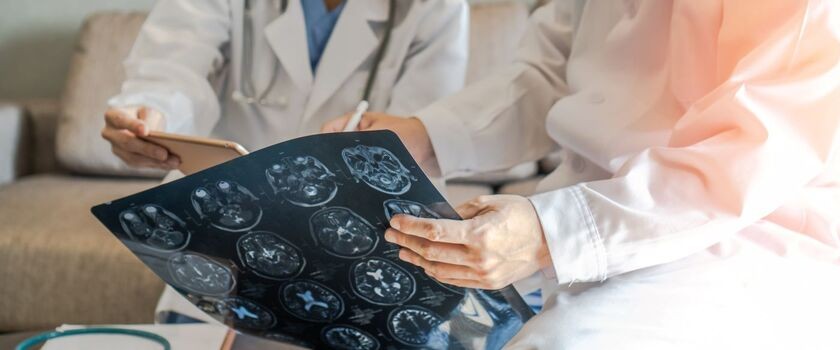 Medycy oglądający wynik badania mózgu. Udar niedokrwienny mózgu.