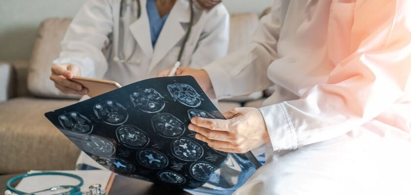 Medycy oglądający wynik badania mózgu. Udar niedokrwienny mózgu.