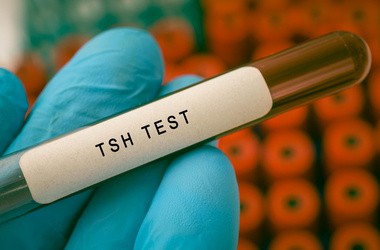 Co należy wiedzieć o badaniu TSH i jak się do niego przygotować?