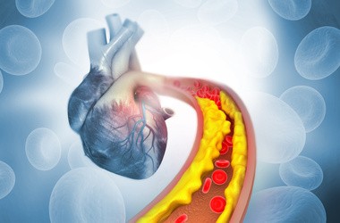 Czym jest cholesterol i jakie są jego normy dla osób dorosłych i dla dzieci?