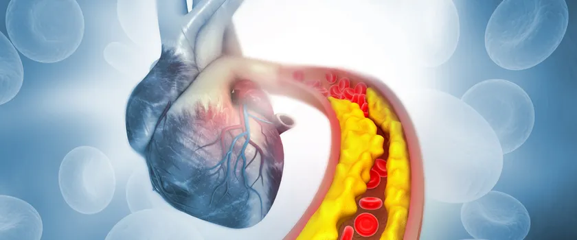 Czym jest cholesterol i jakie są jego normy dla osób dorosłych i dla dzieci?