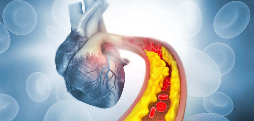 Czym jest cholesterol i jakie są jego normy dla osób dorosłych i dla dzieci?