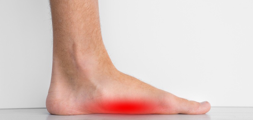 Metody leczenia płaskostopia