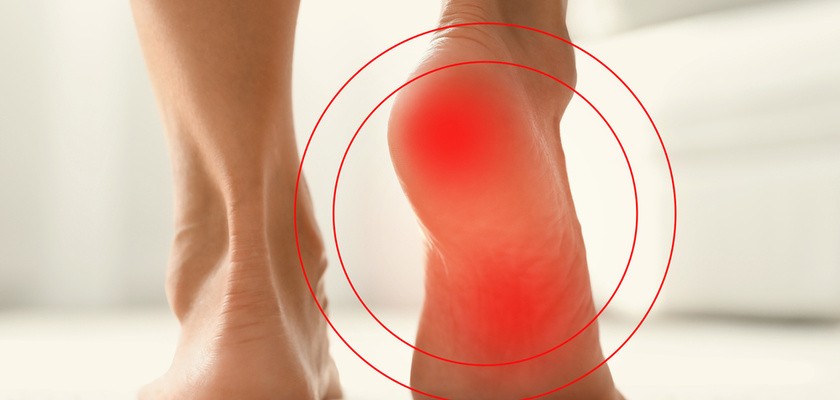 ból stóp od spodu podczas chodzenia zaznaczone na czerwono
