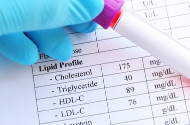Wynik testu profilu lipidowego z probówką z próbką krwi.