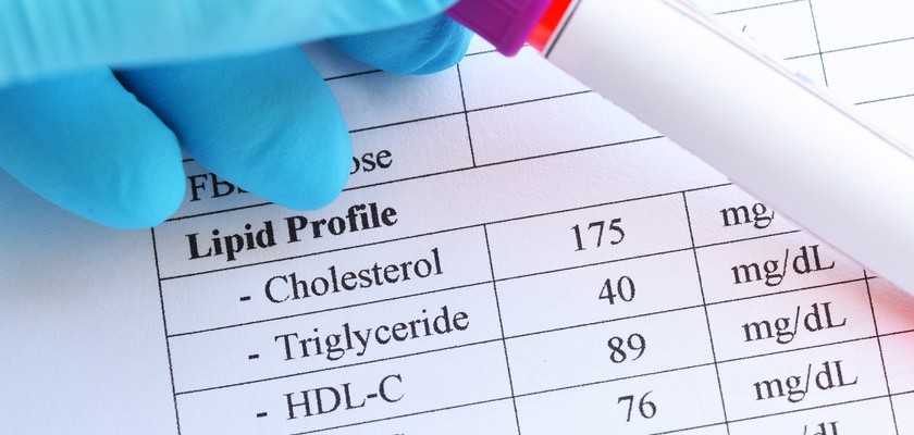 Wynik testu profilu lipidowego z probówką z próbką krwi.