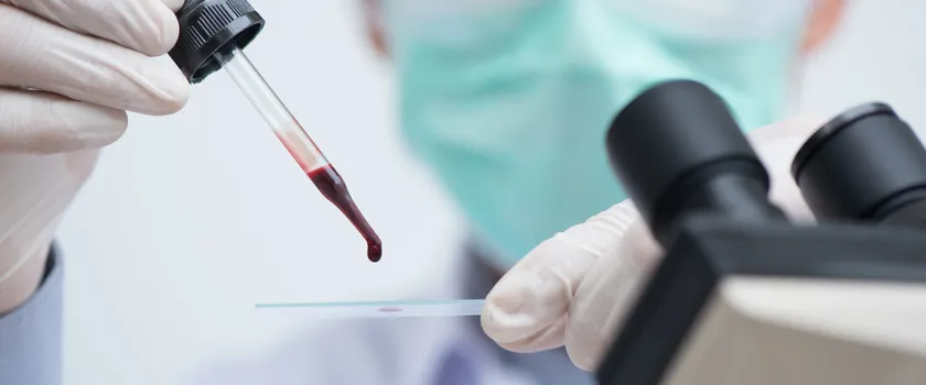 Diagnosta w laboratorium przygotowuje krew do badania.