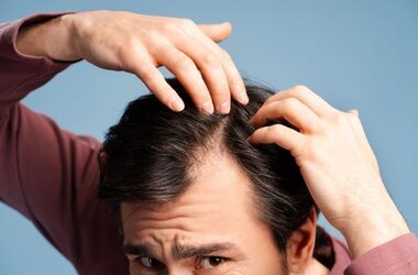 minoksydyl, minoxidil, łysienie u mężczyzn, preparat na łysienie, wypadanie włosów