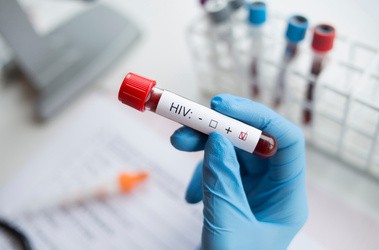 HIV – co warto wiedzieć o objawach zakażenia wirusem?