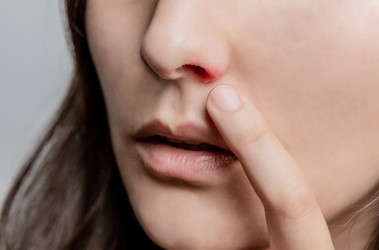 Opryszczka w nosie u kobiety
