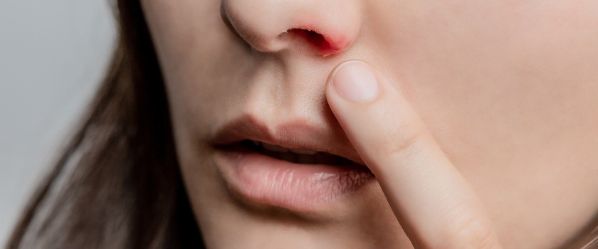 Opryszczka w nosie u kobiety