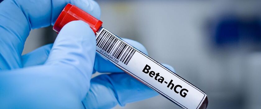 Badanie beta hcg wykryje ciążę na wczesnym etapie.