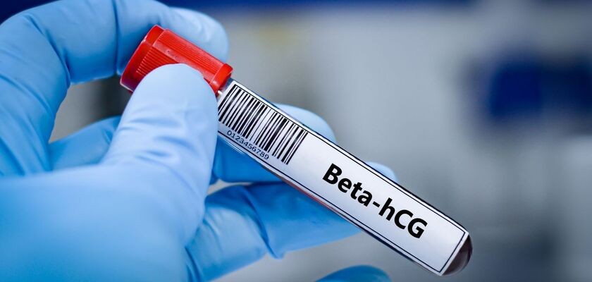 Badanie beta hcg wykryje ciążę na wczesnym etapie.