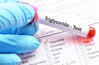 Probówka z krwią do testu trójglicerydów.