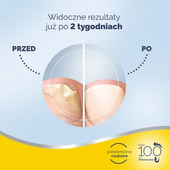 Scholl, preparat na grzybicę paznokci, 3,8 ml