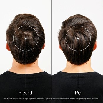 Klorane, kuracja przeciw wypadaniu włosów z chininą i kofeiną, 100 ml