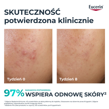 Eucerin Dermopure Clinical, kuracja złuszczająco-wygładzająca Peeling 10, 40 ml