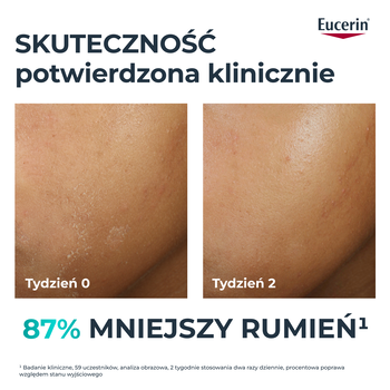 Eucerin Dermopure Clinical Hydra Repair, krem kojący, 40 ml