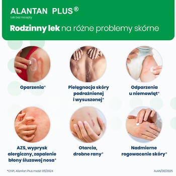 Alantan Plus, (20 mg + 50 mg)/g, maść, 30 g