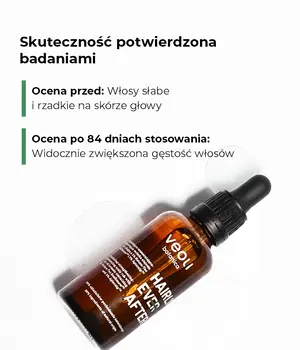 Veoli Botanica Hairly Ever After, wcierka stymulująco-wzmacniająco-regenerująca, 50 ml