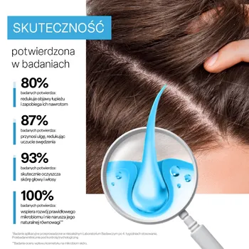 Biovax Trychologic Łupież, szampon do włosów i skóry głowy, 200 ml