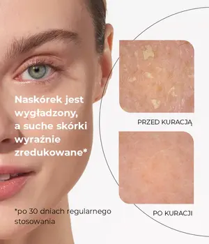 Veoli Botanica Focus Hydration Gel, serum ultranawilżające, 30 ml