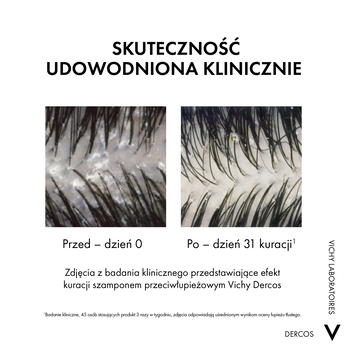 Vichy Dercos DS, szampon przeciwłupieżowy z odżywką 2w1, 200 ml
