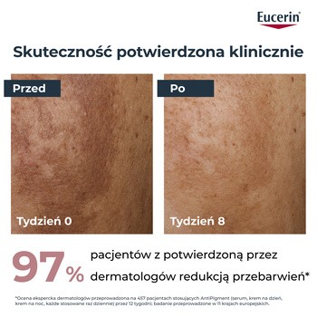 Eucerin Anti-Pigment, serum o podwójnym działaniu z Thiamidolem, przeciw przebarwieniom, 30 ml